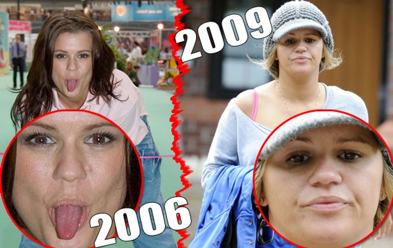 Kerry Katona îşi distruge nasul din cauza cocainei