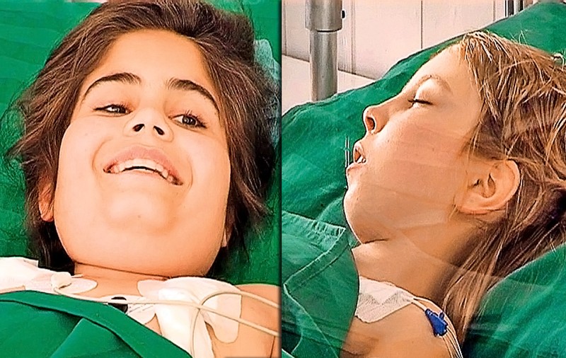 Fetiţa care s-a spânzurat cu un cearceaf a salvat mai multe vieţi