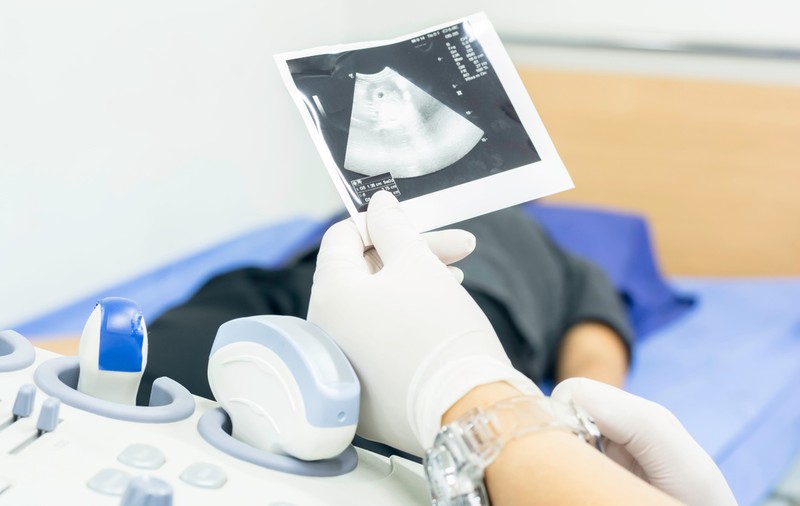 60% din spitalele de stat din România nu fac avorturi la cerere. “Sunt comunități în care o mătură și un pat se consideră metodă contraceptivă”