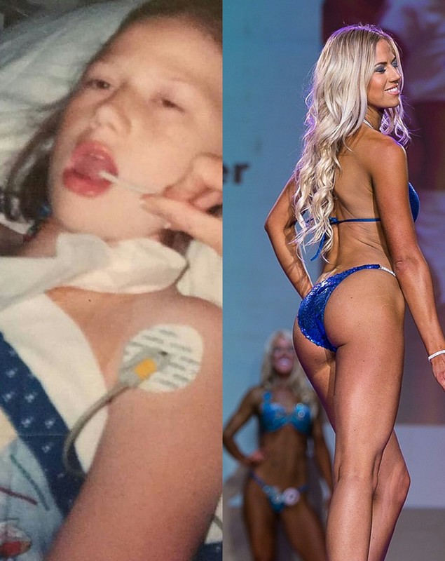 FOTO | Povestea culturistei care a fost de doi ori în moarte clinică și a avut patru operații pe cord