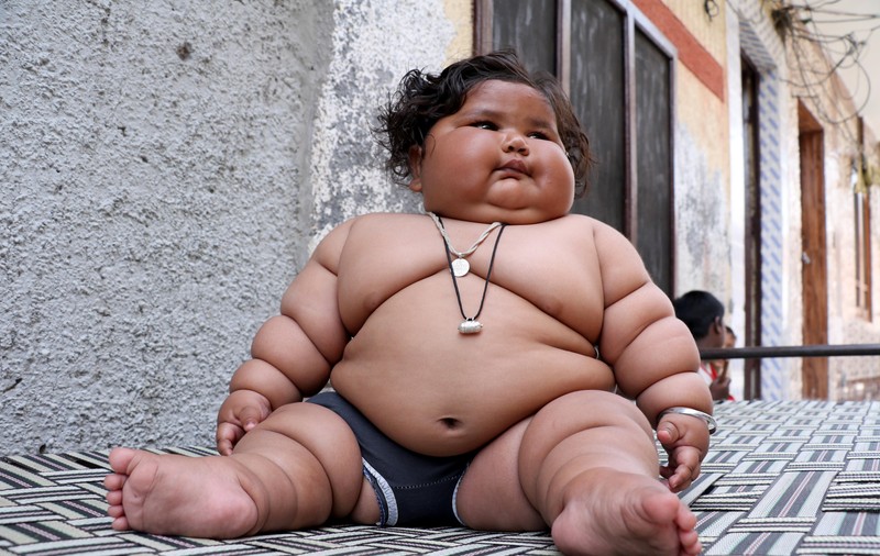 Bebeluș obez în India. La opt luni, o fetiță cântărește 17 kilograme