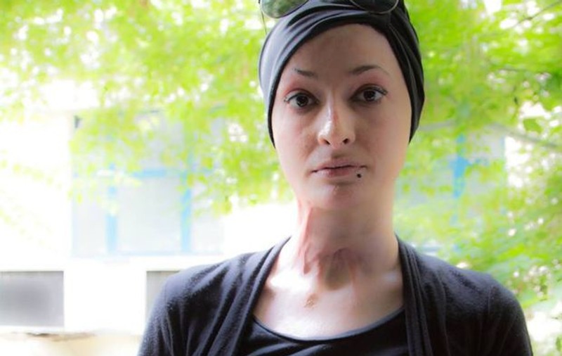 Tedy Ursuleanu, mărturii din infern, la doi ani de la Colectiv.  “Îmi atârna pielea de unghii…”