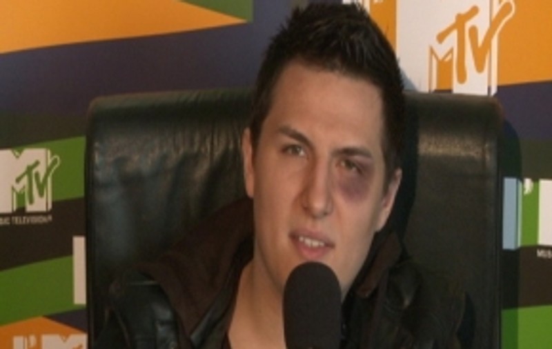 VIDEO / Gabi Huiban prezintă MTV “Euro Top 20” cu un ochi vânăt!