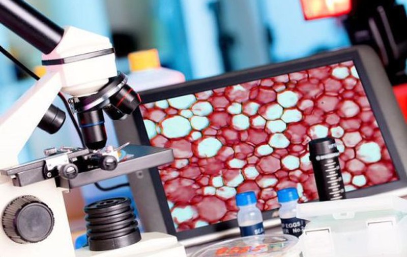 Biopsia lichidă, un nou test util pentru bolnavii de cancer