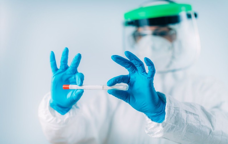 Peste 2.500 de teste pentru depistarea coronavirusului neautorizate în România au fost oprite la vamă