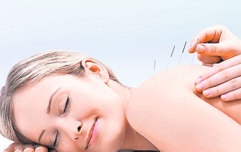 Tratează-ţi durerile de cap prin acupunctură