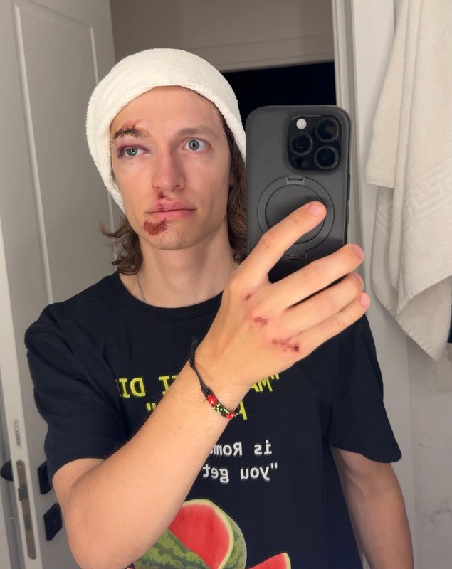 Ce a pățit un influencer venit din SUA după ce a mers cu trotineta prin București: „Noroc că eram în fața spitalului”