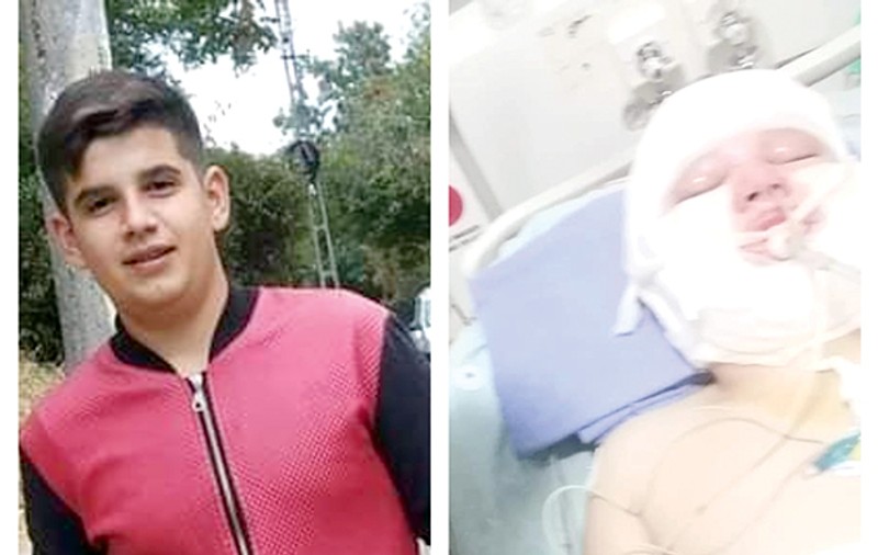 Pompierii din Huși l-au ajutat de două ori pe elevul ars în explozia de la service. L-au salvat din flăcări, apoi au donat bani pentru tratament