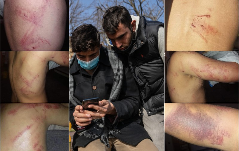 „Nu ai nevoie să îi bați. Ei sunt cuminți”. De ce pe corpurile migranților care traversează România apar semne de „baston metalic”?