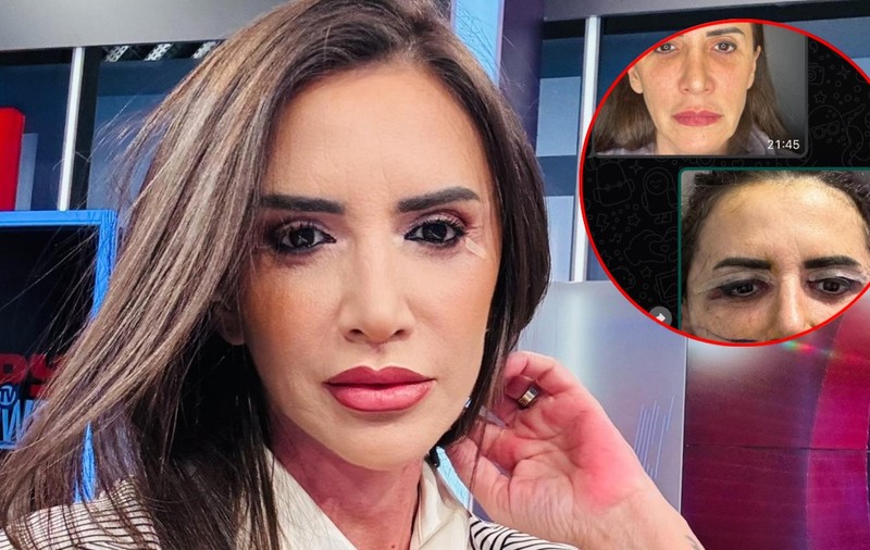 Cum arăta Mara Bănică înainte de liftingul facial. Motivul pentru care a apelat la medicul estetician: „Nu mi-a fost rușine cu cine sunt”
