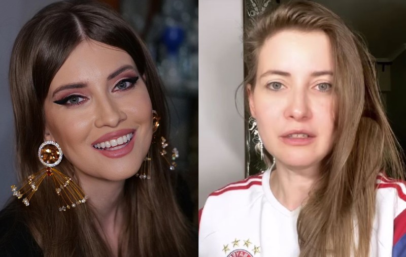 Motivul pentru care Iulia Albu are fața umflată: „Este o problemă pe care abia acum am reușit să o rezolv”