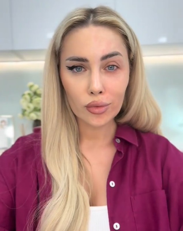 Cum arată Oana Monea nemachiată. Și-a șters make-up-ul în fața fanilor ei: „Aud mereu același lucru: «Ai riduri! De ce nu le injectezi»”