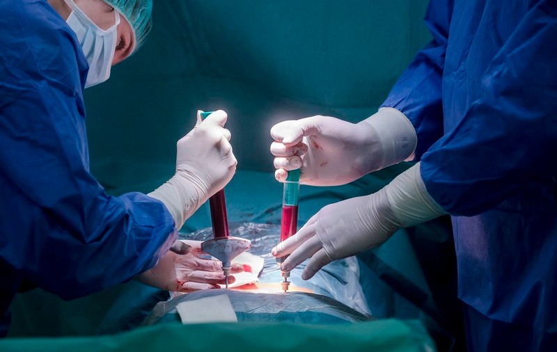 Un nou transplant de celule stem pare să fi vindecat de HIV o a treia persoană în lume