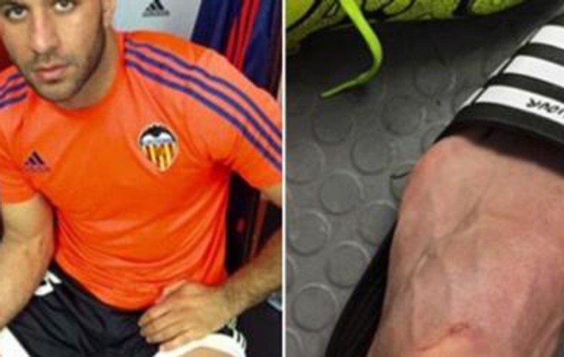 Barcelona, ținută în șah la Valencia. ”Canibalul” Suarez a mai făcut o nenorocire. Benzema ”dublă” cu Getafe / VIDEO