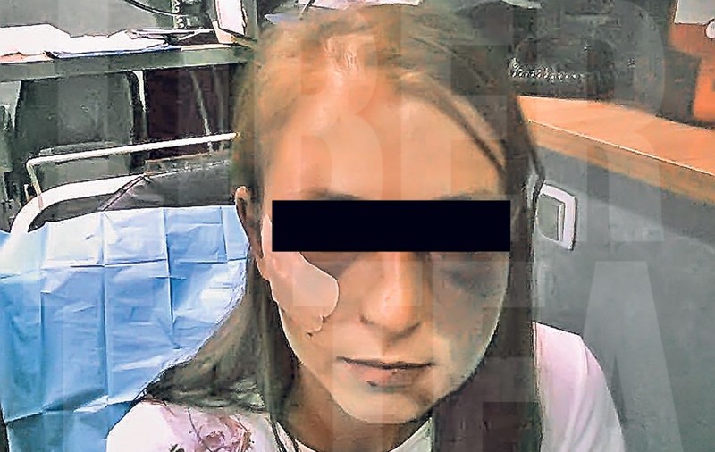 Ruptă cu bătaia timp de 22 de ore! O tânără din Lugoj este de nerecunoscut după ce iubitul gelos a călcat-o, practic, în picioare