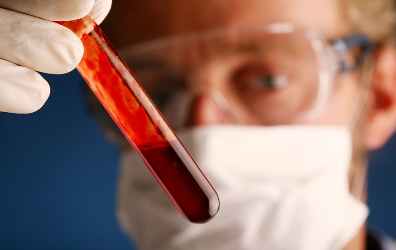 Teste HIV la domiciliu, începând de anul viitor