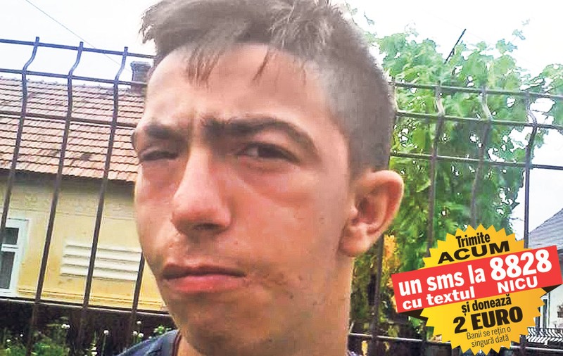 Nicuşor are nevoie de ajutor! Un adolescent de 17 ani cu cerul gurii despicat în două poate fi operat în Turcia