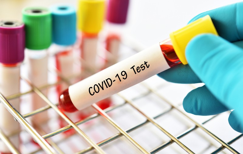 Salt important în lupta cu noul coronavirus. Institutul „Cantacuzino” a reușit să ajungă la procesarea a 400 de teste Covid-19 pe zi