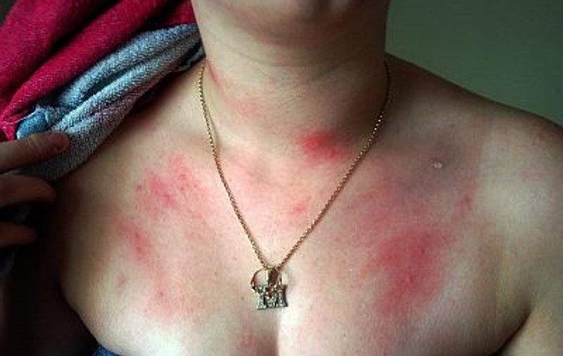 Nu se poate spăla nici pe ea şi nici copilul pentru că e alergică la apă