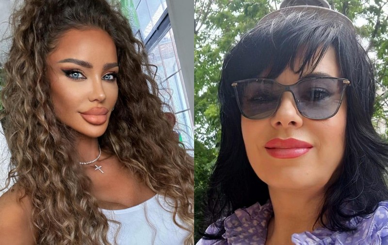Mariana Moculescu și-a făcut o intervenție estetică în valoare de 2.000 de euro: „Vreau să intru în competiție cu Bianca Drăgușanu”