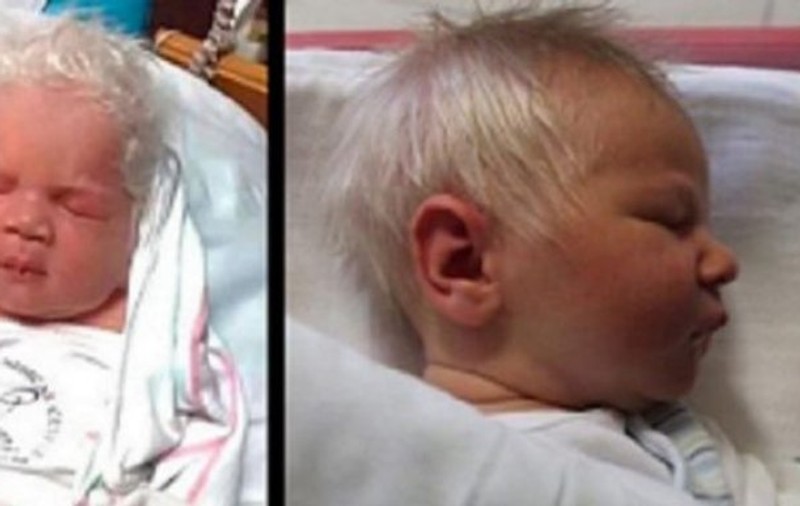 Povestea lui Bence este unică în lume. Nu suferă de albinism