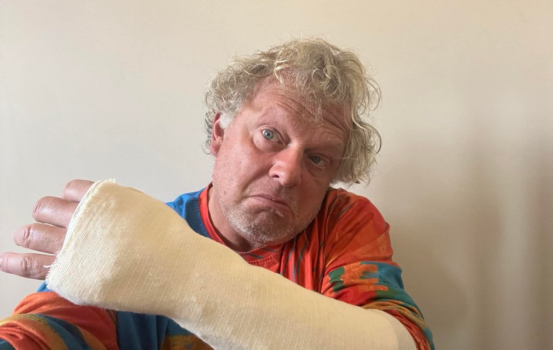 Leonard Miron a ajuns la spital cu mâna ruptă și o coastă fisurată: „M-am împiedicat și am alunecat vreo 4-5 trepte”