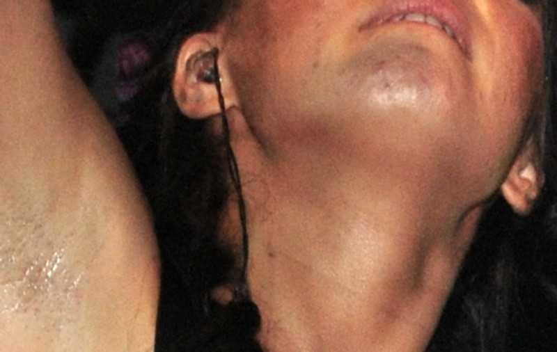 IMAGINE HORROR! O cântăreaţă îndrăgită de la noi, PLINĂ DE BUBE şi NEEPILATĂ! Uite ce apariţie JENANTĂ a avut la un concert | FOTO