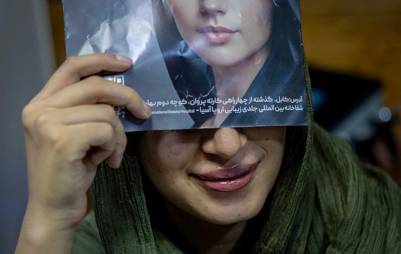 Chirurgia estetică înflorește în secret în Afganistan, sub nasul talibanilor: „Botox pe sub burka. Să fim frumoase în oglindă ne dă energie!”