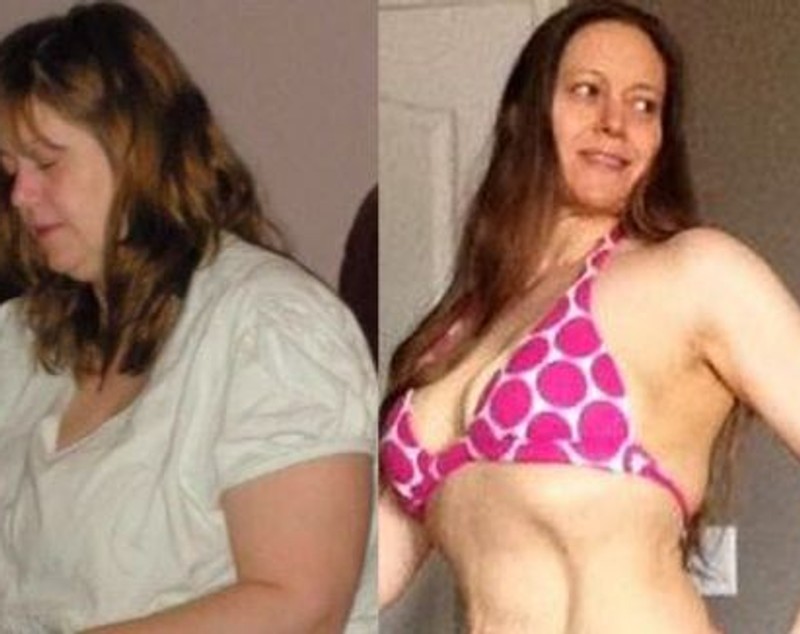 FOTO | O femeie care avea 120 de kilograme susține că a pierdut jumătate din greutatea corporală pentru că și-a băut urina