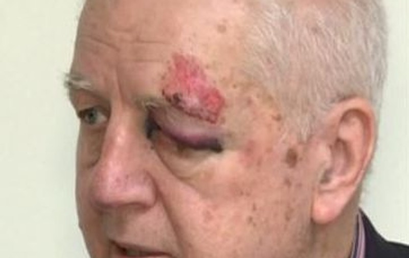 Jean Pădureanu, bătut şi tâlhărit în Bucureşti | VIDEO