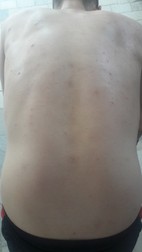 Coloana greu încercată a lui Pletea