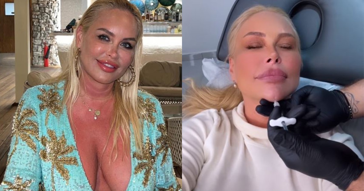 Vica Blochina - intervenții estetice