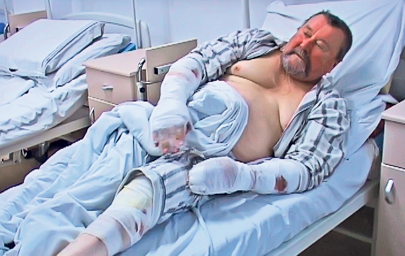 Vasluian atacat de 14 maidanezi, salvat de patrupedele lui: «A fost un accident, eu tot iubesc câinii»