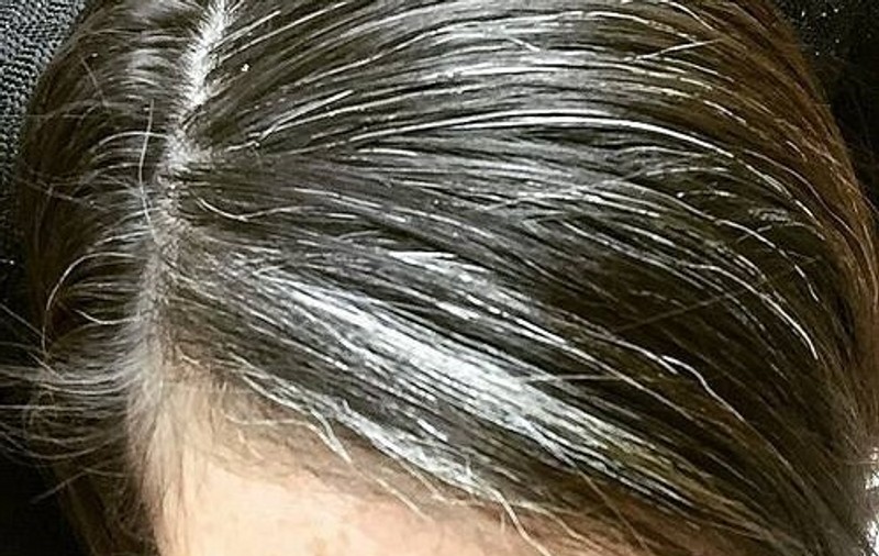 Amestecul din 2 ingrediente care ajută PĂRUL ALB să revină la culoarea iniţială