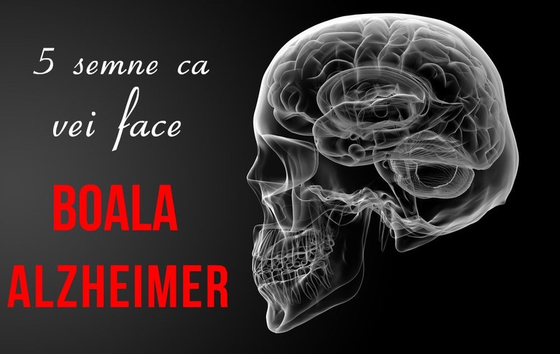 SEMNE CĂ VEI FACE ALZHEIMER