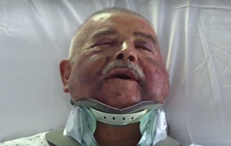 Chirurgul italian torturat de români: "Eram convins că ne omoară". Ce reacție ar avea dacă i-ar întâlni pe atacatori