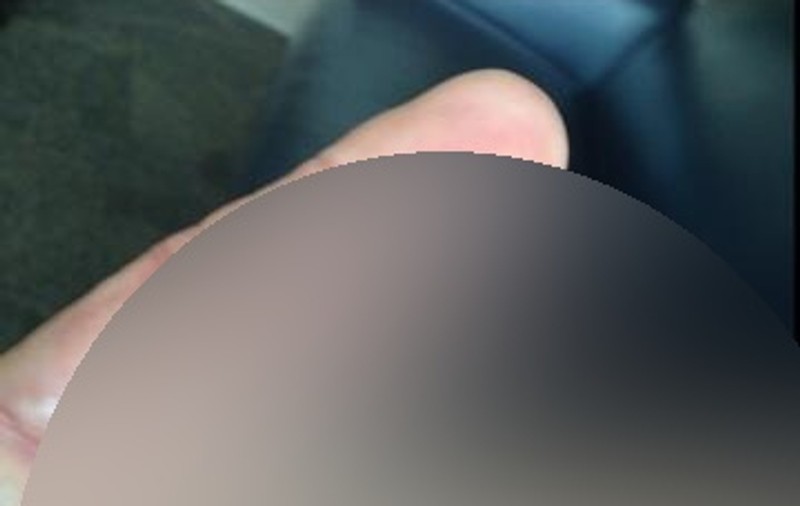 ŞOCANT! Actor CELEBRU, cu MÂINILE DISTRUSE, după explozia unui calorifer | FOTO EXPLICIT