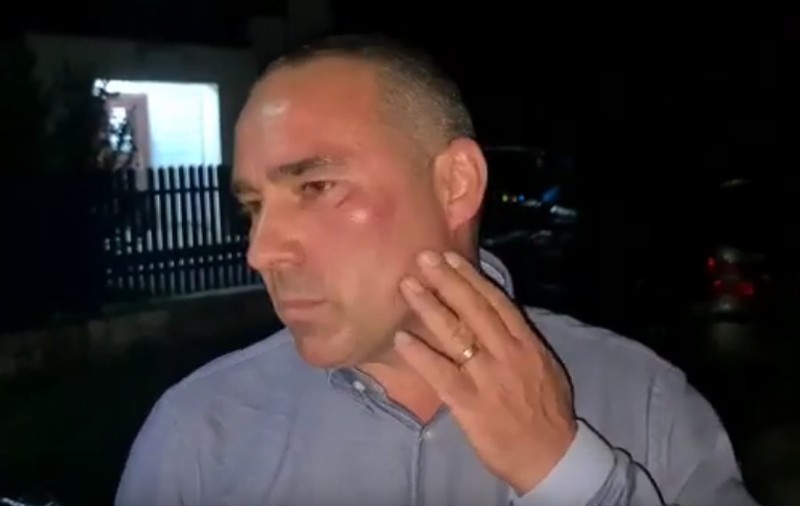 Un edil din Dâmbovița susține că a fost bătut de un localnic pe care l-a prins că arunca deșeuri: "Mi-a dat în falcă"