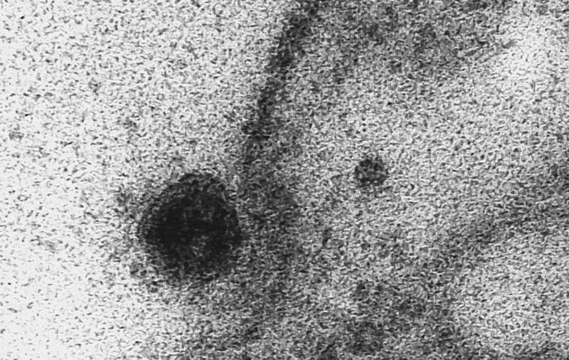 Cum ne atacă coronavirusul.  Momentul în care Sars-CoV-2 infectează o celulă perfect sănătoasă a fost surprins în imagini inedite