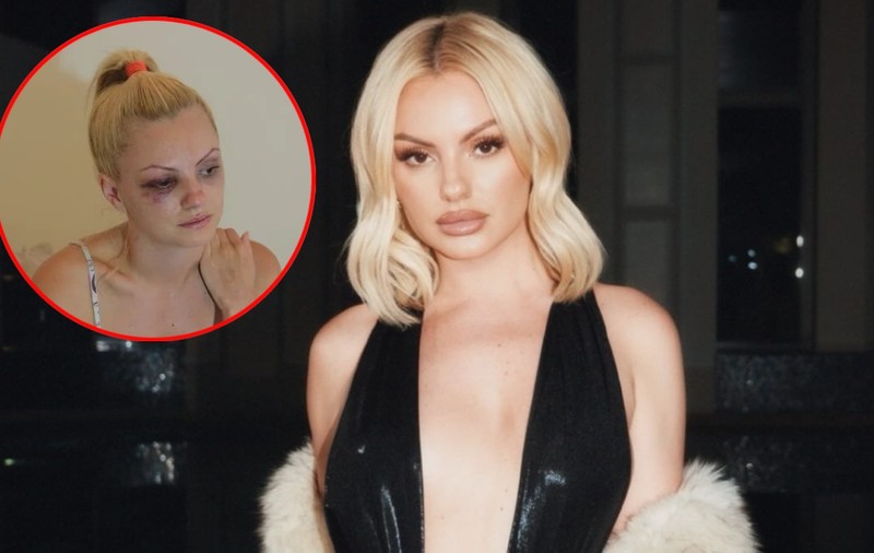 Crima din Cosmopolis a redeschis răni vechi pentru Alexandra Stan. Artista a fost victima violenței în trecut: „Agresiunea nu e doar cea fizică, ci și psihică și emoţională”