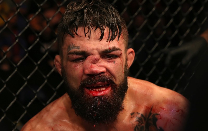 VIDEO | Imagine șocantă. Luptătorul american de MMA Mike Perry a terminat cu nasul rupt gala de la Montevideo