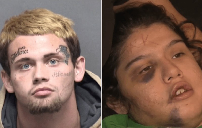 Un adolescent american și-a bătut iubita și și-a scris numele cu un cuțit pe fruntea ei. Victima are maxilarul rupt în trei locuri