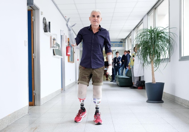 Roberto 'Massiccione' Zanda, concurentul italian căruia i-au fost amputate membrele din cauza degerăturilor suferite în timpul Maratonului Yukon Arctic Ultra. Sursă foto: EPA.