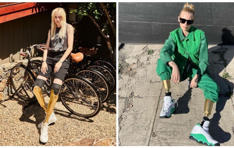Povestea incredibilă a modelului care a rămas fără picioare din cauza unui tampon. A sfidat toate piedicile puse de soartă