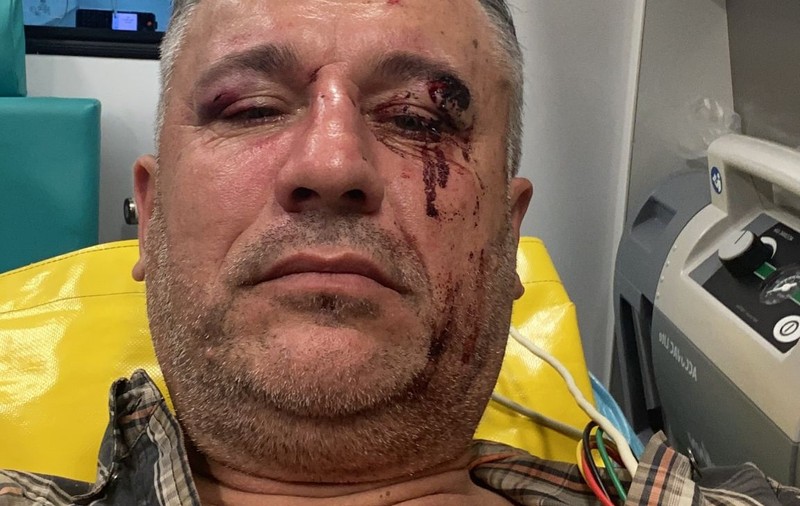 Un activist de mediu şi doi jurnaliști, bătuţi crunt în județul Suceava, când filmau un material despre tăierile ilegale de păduri