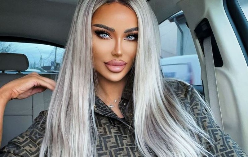 Bianca Drăgușanu și-a topit acidul hialuronic din buze: „Fața mea a fost stricată. M-am injectat vreo 20 de ani mult și prost”
