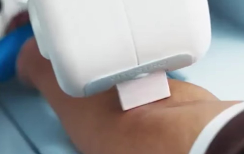 Primul robot din lume care îți găsește vena și îți recoltează singur sânge a fost autorizat în SUA