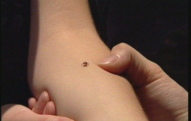 Un copil din Arad a fost diagnosticat cu boala Lyme după ce a fost mușcat de o căpușă!