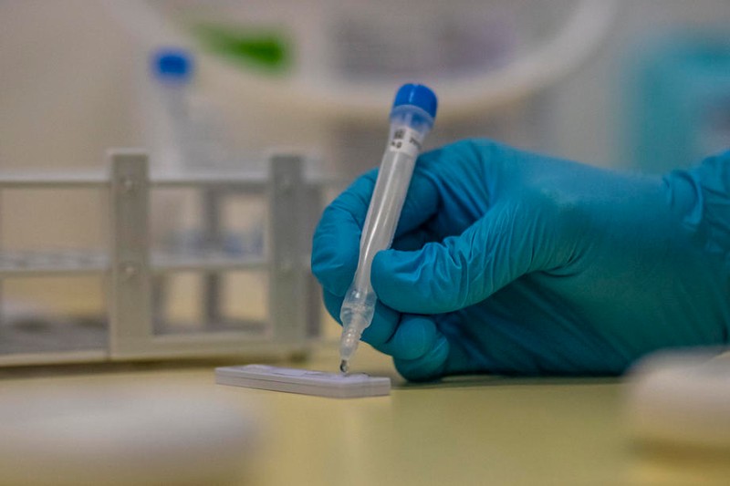 Testarea antigen sursa foto: EPA