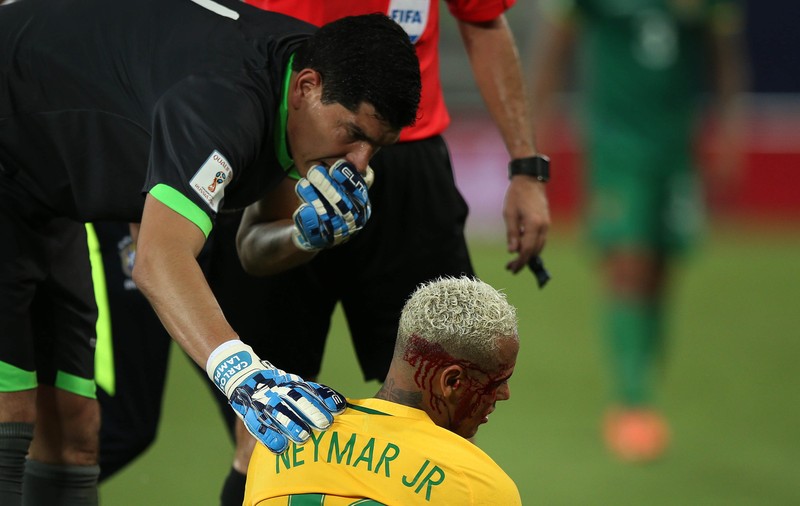 Neymar a plătit cu sânge golul 300. Un bolivian i-a spart fața starului Barcelonei cu un procedeu de MMA / GALERIE FOTO&VIDEO